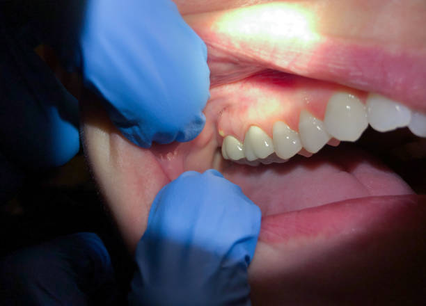 Best Cracked Tooth Emergency Dentist  in Braidwood, IL
